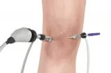 Arthroscopic surgeon in nallasopara