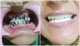 Dental hospital near me