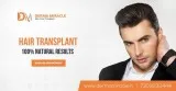 Derma miracle: hair transplant & skin treatment clinic
