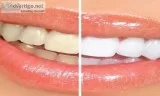 Best dentist in panchsheel park