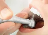 Best dental clinic in delhi with best dentist & dental treatment