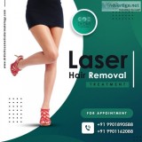 Laser hair removal in bangalore