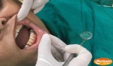 Dental Bridge Gurgaon 4 Types Benefits Use Case and Costs