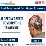 Best alopecia areata homeopathic treatment