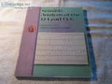 Sensible Analysis of the 12-lead ECG