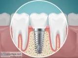 Dental clinic in naranpura