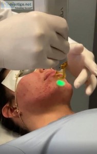 Aesthetic Laser