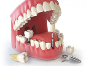 USA Trained Dentist in Ahmedabad