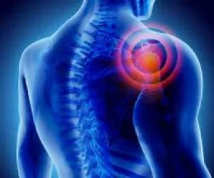 Frozen shoulder,Joint, Back Pain etc - Dr. Scott