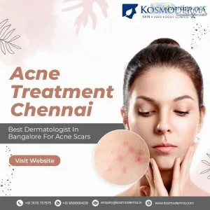 Best acne treatment in bangalore, chennai - pimple treatment