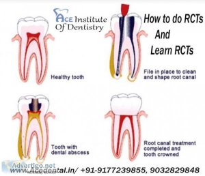How To Do RCTs  Learn RCTs in India