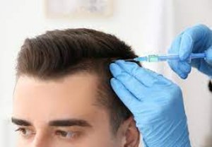Hair loss treatment cost in chennai