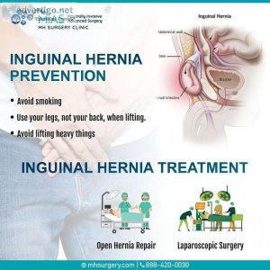 Mh surgery clinic: best surgery hospital in bangalore