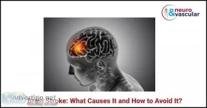 Brain stroke: what causes it and how to avoid it?