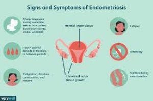 Best endometriosis doctor in jaipur