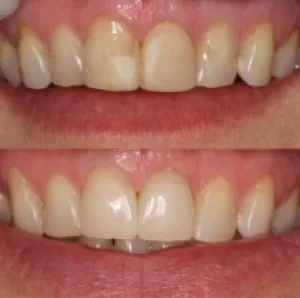 Find the top-rated dentist in langley