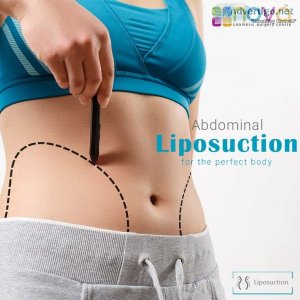 Liposuction | fat removal surgery ? nova cosmetics center