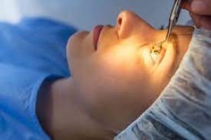 Lasik surgery in ahmedabad, best lasik surgeon in ahmedabad 
