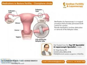 Best infertility clinic & hospital in bangalore