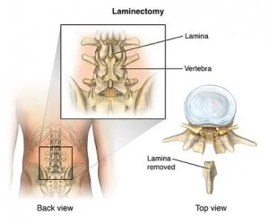 What are the conditions treated by spine surgeons?