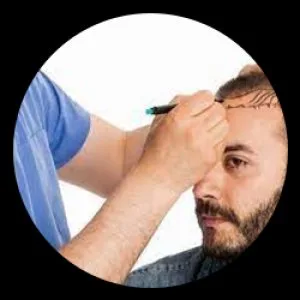 Find the hair specialist in gurgaon