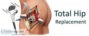 Hip replacement surgeons in bavdhan | best hip replacement docto