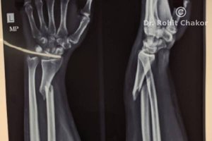 Orthopedic doctor in kharadi | orthopedic surgeon in kharadi | d