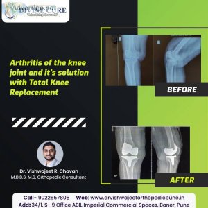 Best orthopedic doctor/ orthopedic surgeon in baner, pune- dr vi