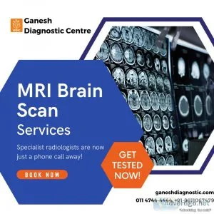Top mri brain scan test centre in delhi | ganesh diagnostic