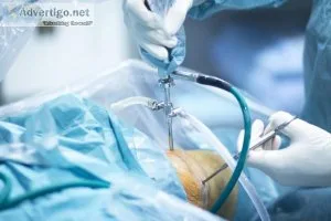 Best arthroscopy surgery in delhi