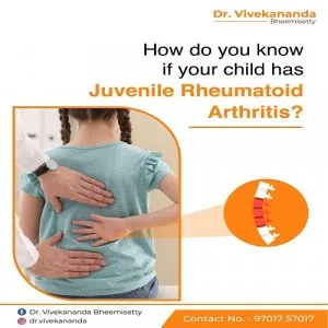 Are you looking for best bone specialist in hyderabad