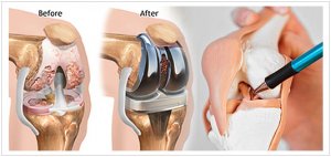 Best orthopedic doctor in jaipur