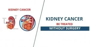 Kidney cancer treatment in ayurveda