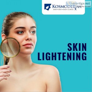 Skin whitening bangalore chennai | skin lightening treatment