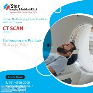 Ct scan is a vital process get it done at your nearest center
