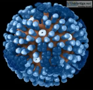 Swine flu