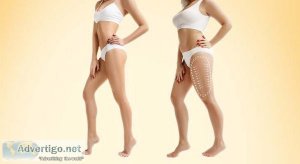 Best liposuction treatment in dubai| liposuction cost in dubai -
