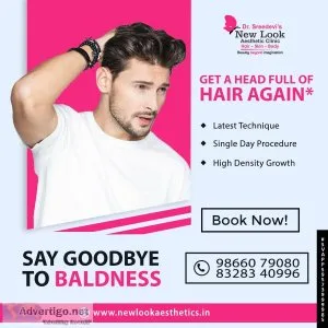 Laser treatment in hanamkonda