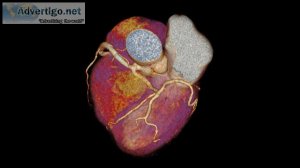 Best hospital for cardiology & heart surgery in surat