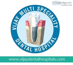 Dental implants | implant | vijay dental clinic | dental service