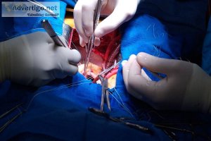 Bypass surgery cost in delhi - consult dr sujay shad
