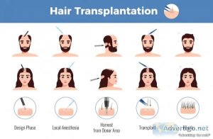 A perfect guide to hair loss treatment in pune