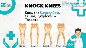 Knock knee surgery cost in india