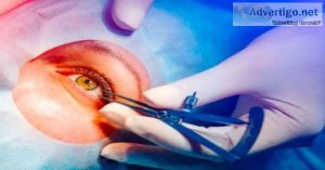 Smile eye surgery cost in india at best hospitals