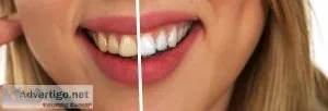 Do This 60 Seconds Dental Trick Before Going to Bed Tonight