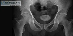 Bladder stone: causes, symptoms, diagnosis and treatment