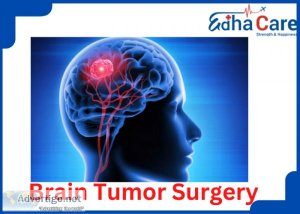Get best brain tumor surgery in india | edhacare