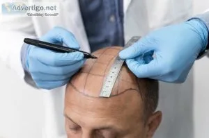 Hair restoration