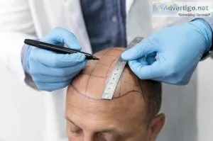 Hair fall treatment in raipur