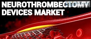Neurothrombectomy devices market to exhibit 99% cagr from 2021 t